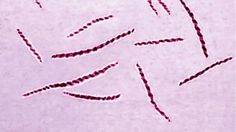 Syphilis-Diagnosen auf Höchststand in Deutschland