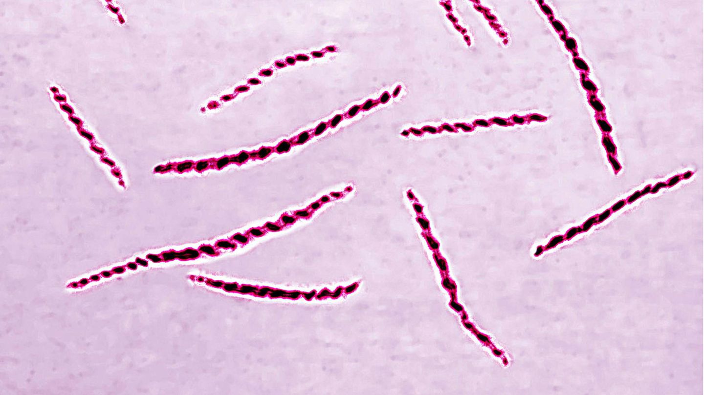Syphilis-Diagnosen auf Höchststand in Deutschland