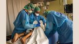 Stuttgart, 31. März 2020 - Marienhospital  Um die Lunge zu entlasten, drehen Gesundheits- und Krankenpfleger einen schwer kranken Covid-19-Patienten auf den Bauch. Der Patient ist Ende 50, hat Übergewicht und hohen Blutdruck.