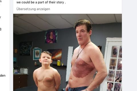 Vater und Sohn stehen nebeneinander. Der Sohn mit Muttermal, der Vater mit einem identischen Tattoo