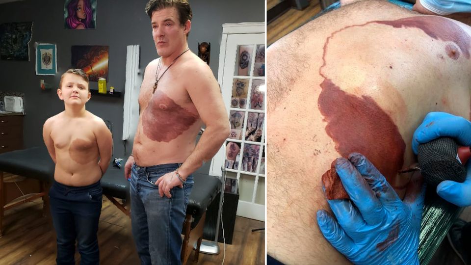 Rührende Bilder: Darum lässt sich dieser Vater ein riesiges Muttermal tätowieren