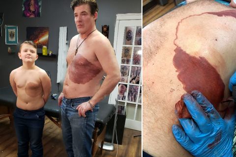 Rührende Bilder: Darum lässt sich dieser Vater ein riesiges Muttermal tätowieren