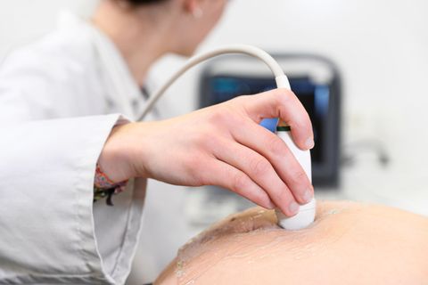 Ultraschalluntersuchungen, die nicht medizinisch notwendig sind, sollen künftig verboten werden