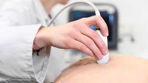 Ultraschalluntersuchungen, die nicht medizinisch notwendig sind, sollen künftig verboten werden