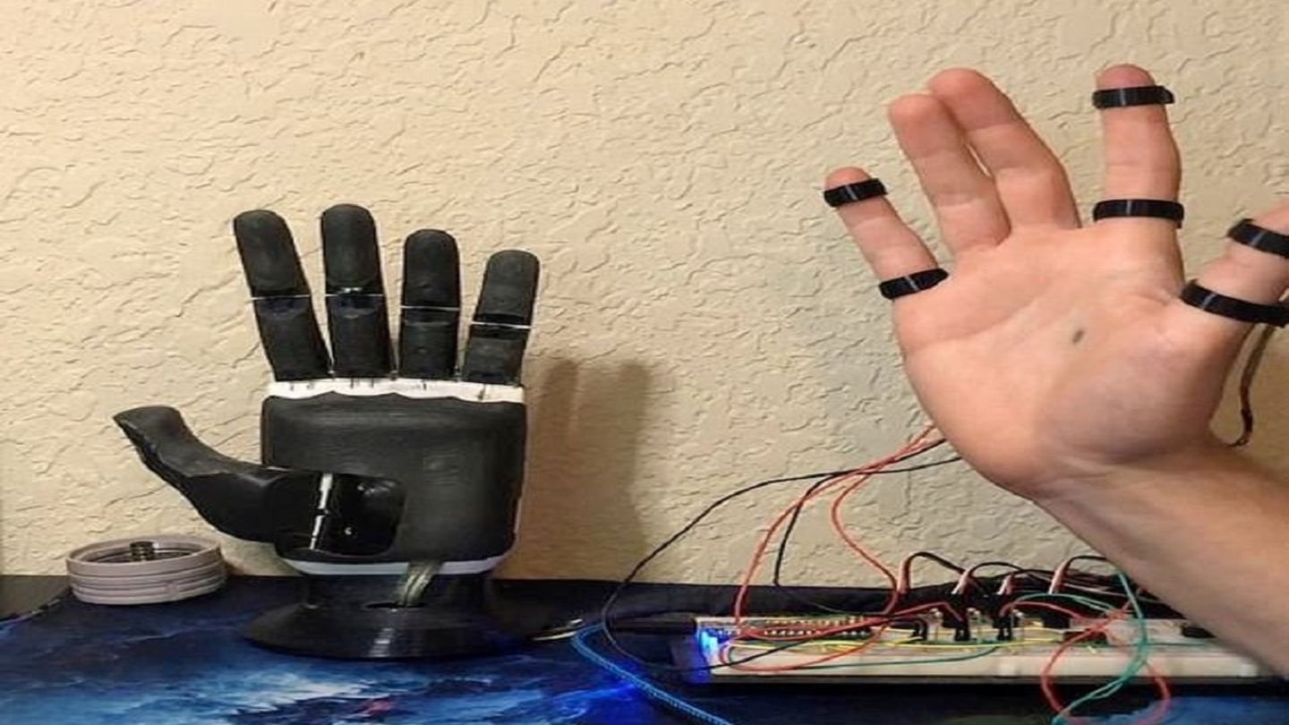 Diese künstliche Hand hilft einem Amputierten fast alle Bewegungen des Alltags durchzuführen.