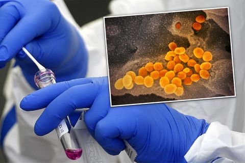 Südafrikanische Coronavirus-Mutation erstmals in Deutschland entdeckt (Video)